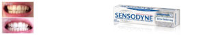 best whiting tooth paste