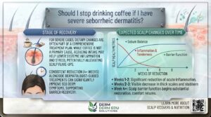 Should I stop drinking coffee if I have severe seborrheic dermatitis?